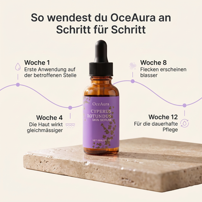 Cyperus Rotundus Altersflecken Serum