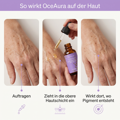 Cyperus Rotundus Altersflecken Serum
