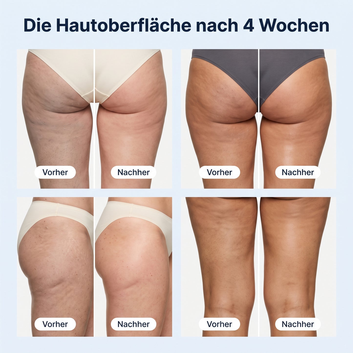 Renuvia SilkTouch - antibakterielles Cellulite-Duschtuch